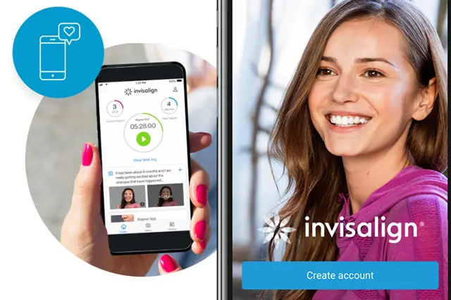 Imagem do artigo - APP My Invisalign