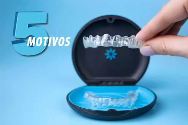 Imagem do artigo - 5 motivos para fazer o tratamento com Invisalign