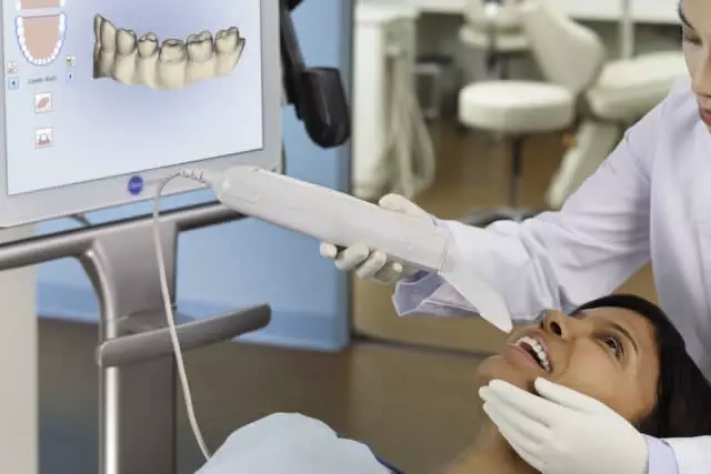 Imagem do artigo - Escaneamento intraoral com o itero no tratamento com invisalign 