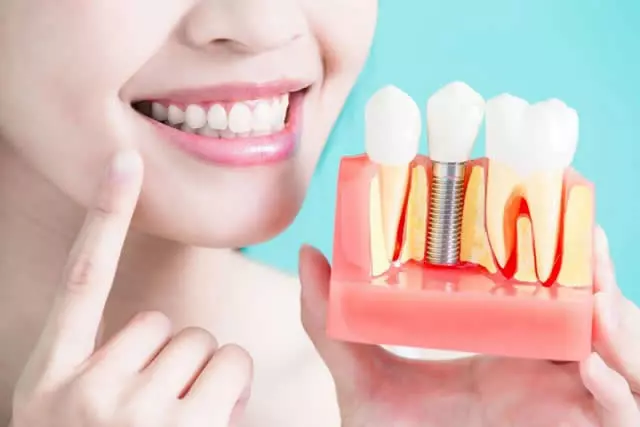 Benefícios de implantes dentários