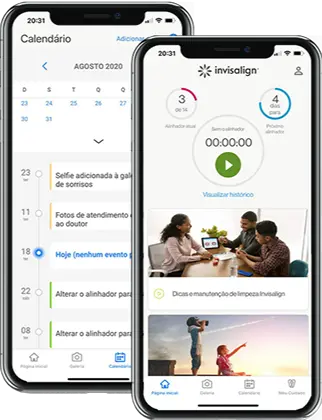 Imagem do artigo - APP My Invisalign